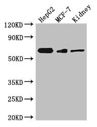 Thumbnail: VANGL2 Antibody