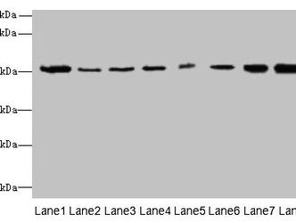 PGS1 Antibody