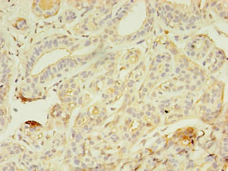 Thumbnail: AZGP1 Antibody