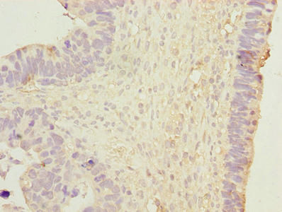 Thumbnail: DNAJB1 Antibody