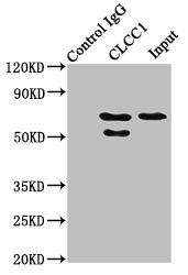 Thumbnail: CLCC1 Antibody
