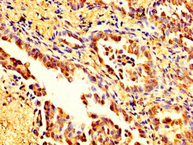 Thumbnail: MSN Antibody