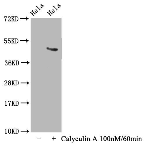 Phospho-MAPT (T231) Antibody