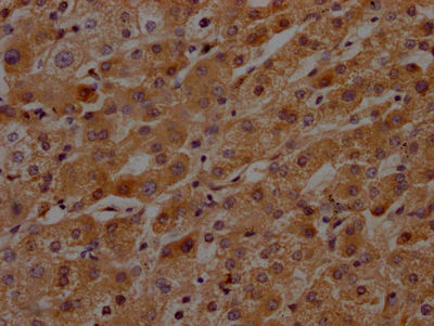 KLKB1 Antibody