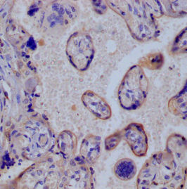 Thumbnail: SLC2A3 Antibody