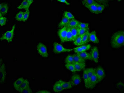 Thumbnail: NCAM2 Antibody