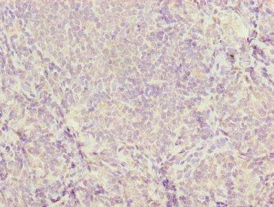 Thumbnail: Cd46 Antibody