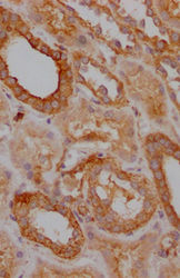 Thumbnail: TRAF2 Antibody
