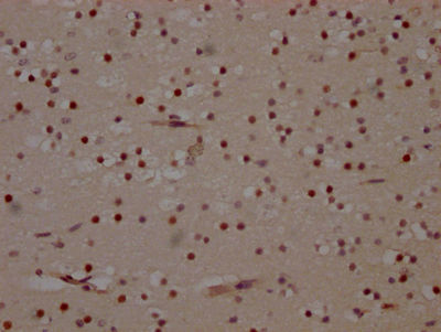 Thumbnail: MAPK14 Antibody