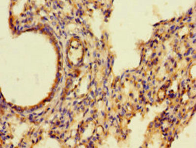 Thumbnail: AIF1 Antibody