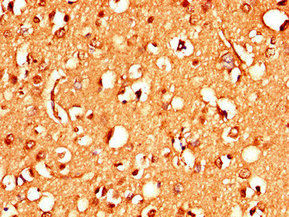Thumbnail: STIM2 Antibody