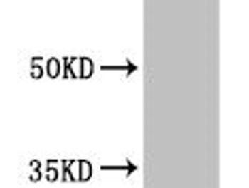 Thumbnail: RAB5A Antibody