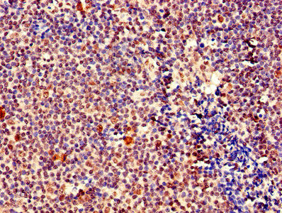 Thumbnail: MEF2D Antibody