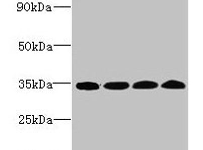WDR61 Antibody