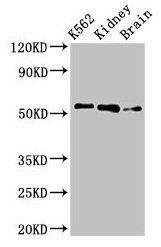 Thumbnail: PFKFB2 Antibody