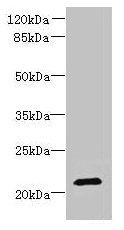 DYDC1 Antibody