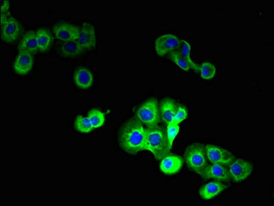 Thumbnail: STEAP1 Antibody