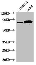 Thumbnail: SLC3A1 Antibody