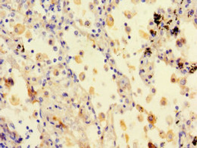 Thumbnail: STXBP6 Antibody