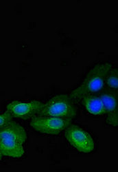 Thumbnail: IMMT Antibody