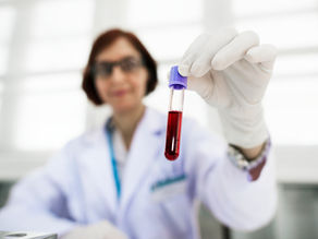 Química sanguínea: una herramienta para conocer el estado de tu organismo