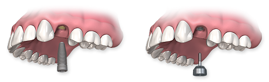 teeth