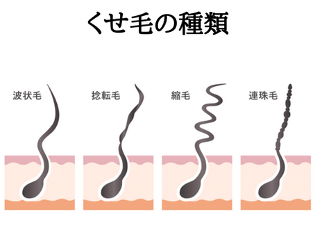 あなたのくせ毛はどのタイプ?「4つの種類」を知って、髪のお悩みを解決しましょう!