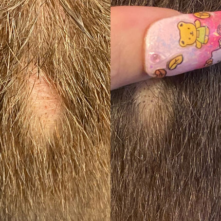 What Is Scalp Pigmentation?