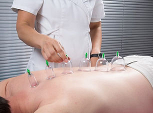 depositphotos_76475029-stock-photo-cupping-therapy.jpg