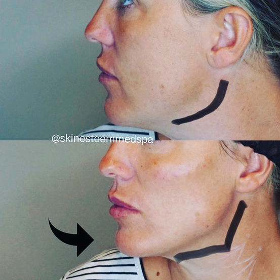facial-balancing.jpg