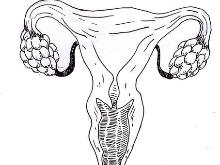 Polycystic Ovary Syndrome - Ace's Story