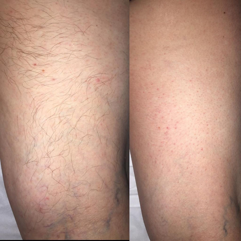 Arm 1