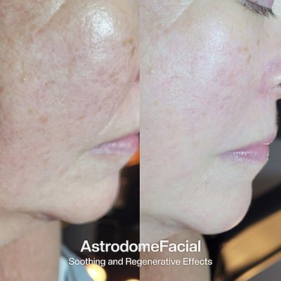 1004_ADF B&A_1.jpg