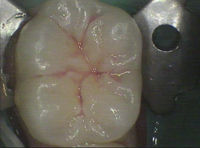 sealant before.JPG