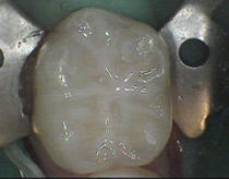 sealant after.JPG