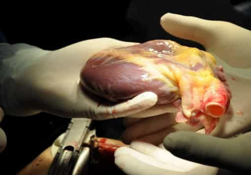 Brasil tem o Maior Sistema Público de Transplantes