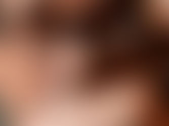 Canabidiol e cicatrização: A ciência da regeneração tecidual através dos fitocanabinoides