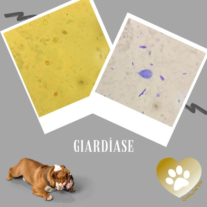 Giardíase