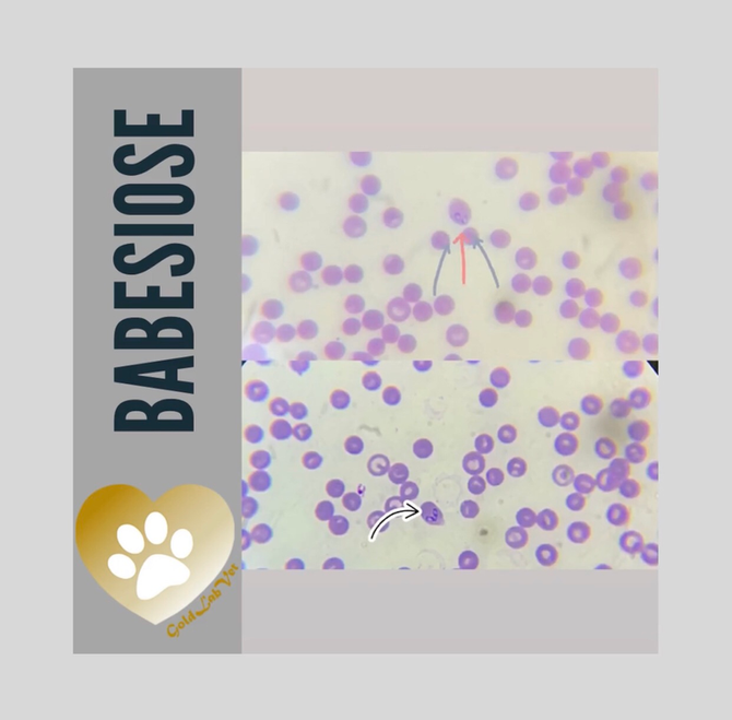 Babesiose