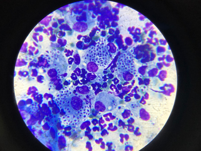 ESPOROTRICOSE