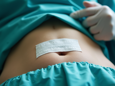 Comprehensive Plastic Surgery Care Tips