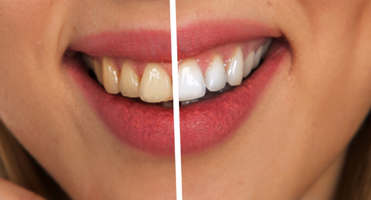 Design sem nome (8).png