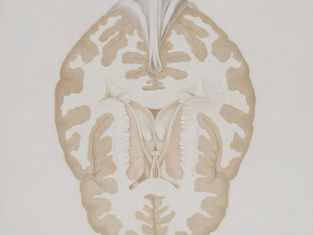 What is Neuroarchitecture? Evidence, Methods, Misconceptions and the Research Behind the Term
