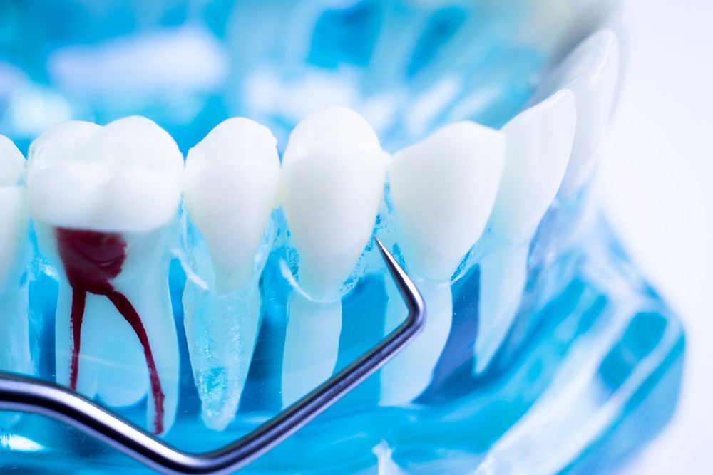 CK Dental City of McKinney TX 75070 Emergency, Invisalign, Family, Cosmetic - Dental Implants, Dental Checkup, Cleaning & Examinations, Crowns, Bridges, Restorations, Veneers, Tooth Extraction, Dentures, Partial Dentures, Teeth Whitening, Emergency Dentist, Invisalign Dentist, Kid Friendly Dentist, Periodontics, Root Canal Therapy