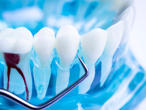 How To Tell When You Need A Root Canal, Explained By Your General Dentist in McKinney, Texas