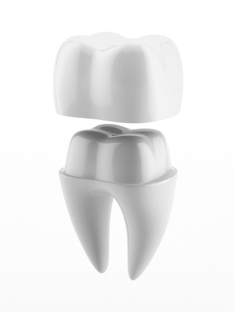 The Dental Crown Procedure Explained By Your General and Family