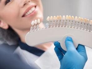 Your General & Cosmetic Dentist in McKinney, Texas Explains Dental Veneers | CK Dental City