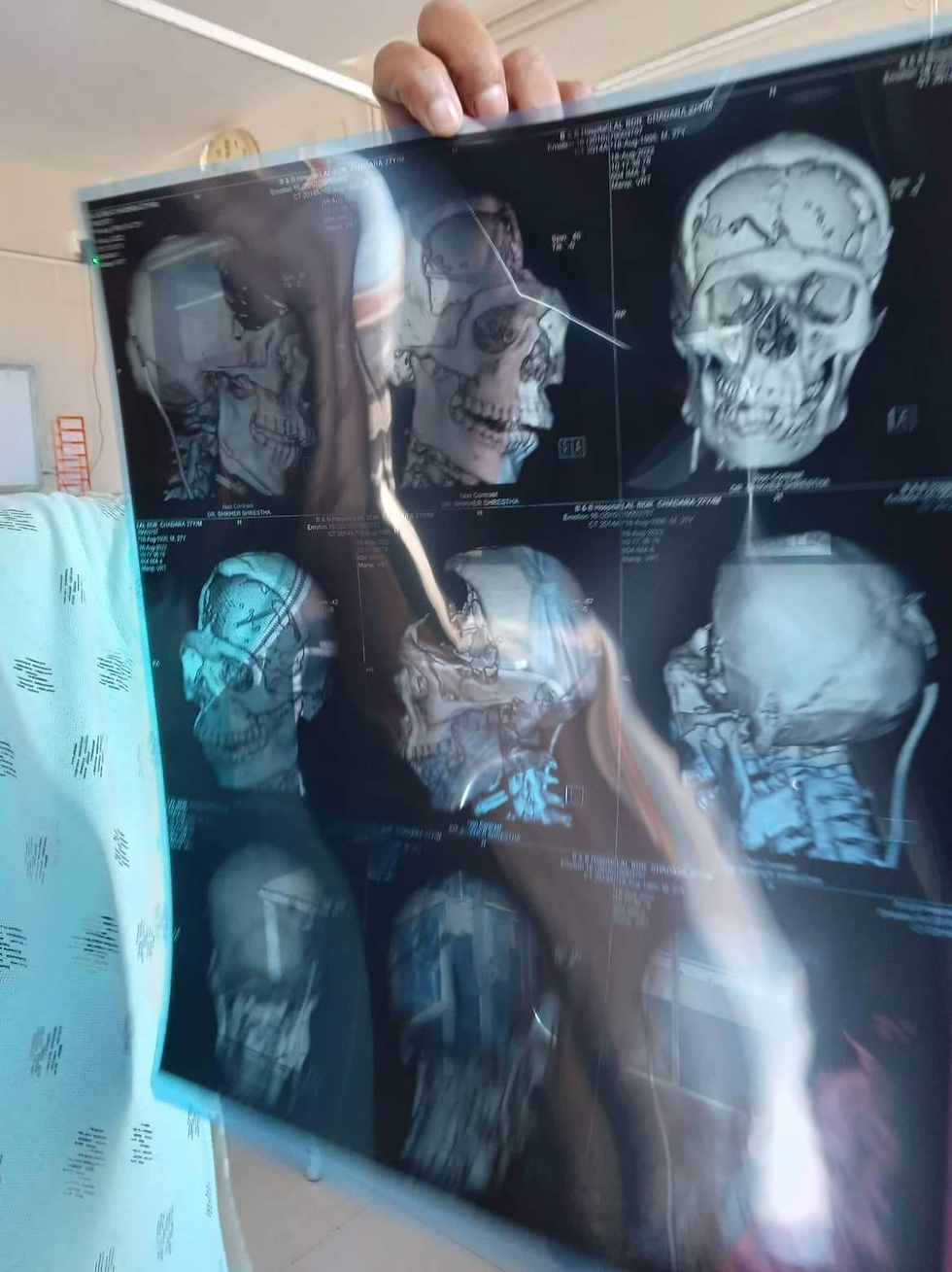 A wife pleads for her husband’s brain surgery. What do you do?