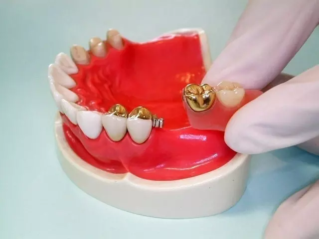 アタッチメント