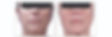 venus facial_edited.jpg